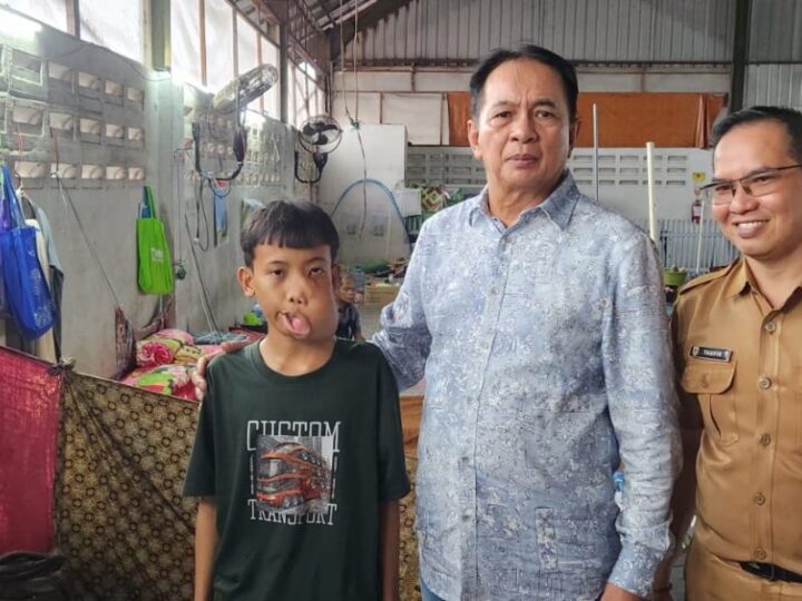 Bupati Muhammad Yamin Kunjungi Pasien Penderita Tumor Asal Desa Lampeong